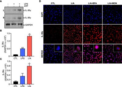IL-36γ is secreted through an unconventional pathway using the Gasdermin D and P2X7R membrane pores